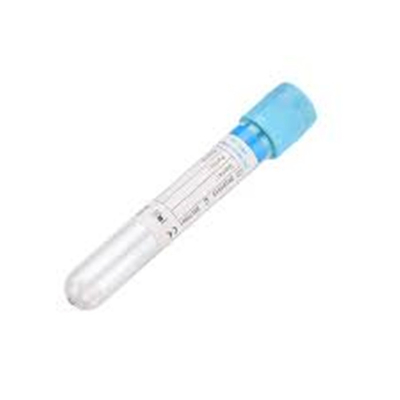 Anticoagulant Sodium Citrate Blue Top Tubes Collection Vial