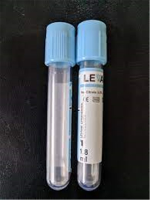 Edta Blood Sample Collection Vials Gel Clot Activator Tube