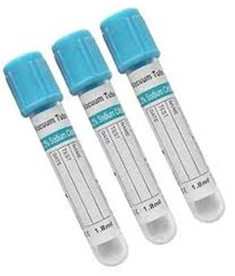 Blue Top Sst Lab Test Serum Gel Tube Edta Vial EOS Disinfecting