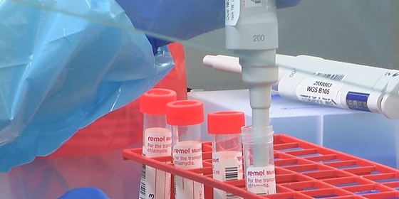 Covid-19 Determination Rapid Self Antigen Test Kit For Home